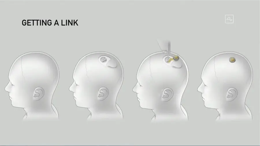 Elon Musk presenta Neuronalink
